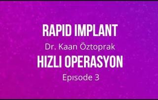 implant surgery episode 3 rapid 9 implant surgery episode 3 rapid 9