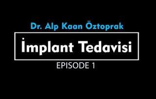 implant surgery episode 1 8 implant surgery episode 1 8