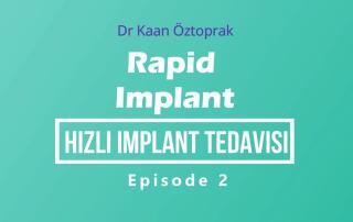 implant surgery episode 2 rapid 7