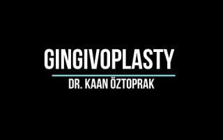 Gingivoplasty 2 Gingivoplasty 2