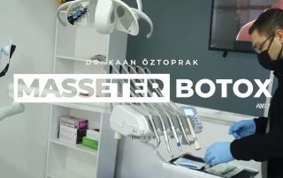 Masseter Botox | Dr. Kaan Öztoprak | Part 2 7