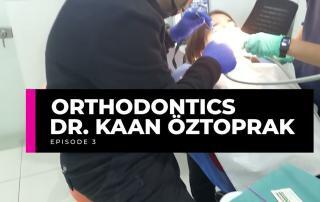 Orthodontics episode 3 | Dr. Kaan Öztoprak 4